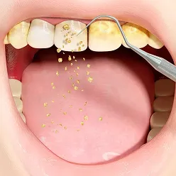 Teeth Cleaning